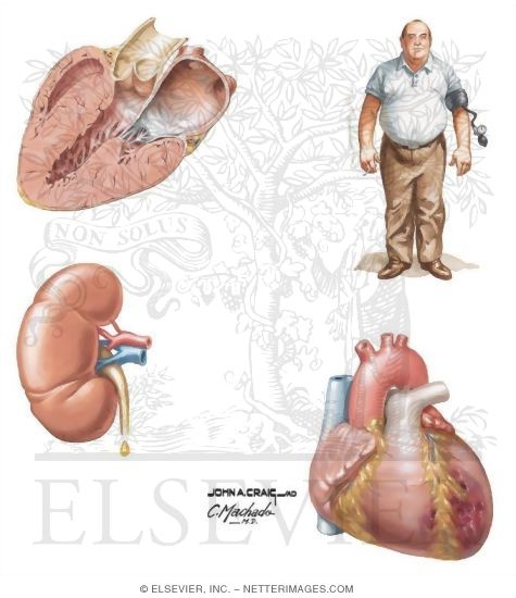 Target Organ Cardiovascular Risk Factors