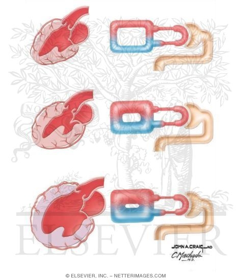 Hypertension and Congestive Heart Failure