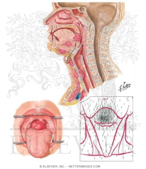 Congenital Anomalies of the Thyroid Gland