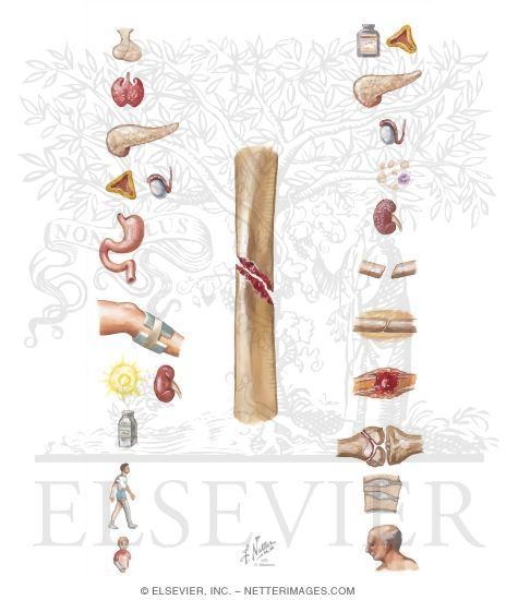 Factors That Promote or Delay Bone Healing