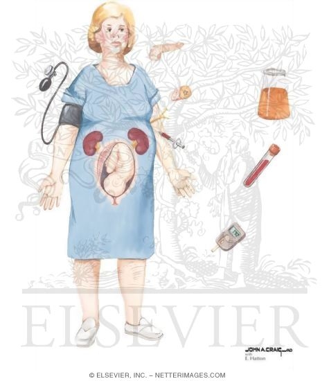 Diabetes In Pregnancy