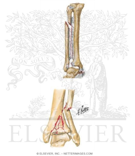 Trauma of the Leg and Knee