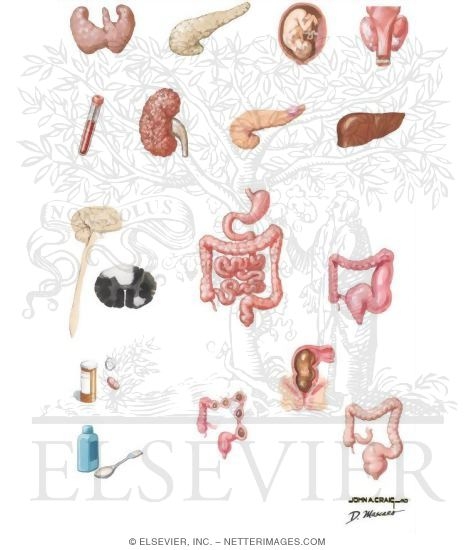 Causes of Constipation