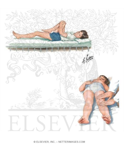 Physical Examination of the Knee