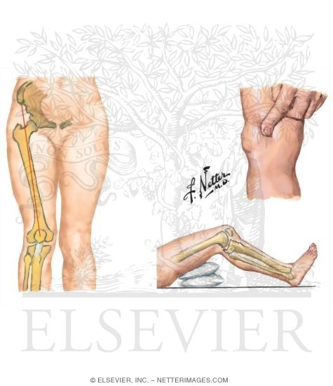 Physical Exam of the Leg and Knee