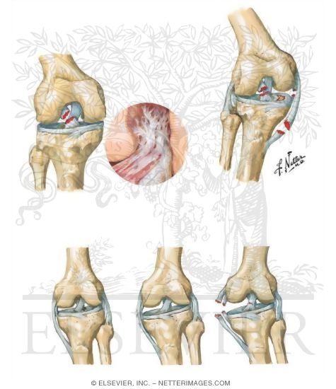 Disorders of the Leg and Knee