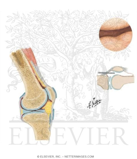 Knee Joints