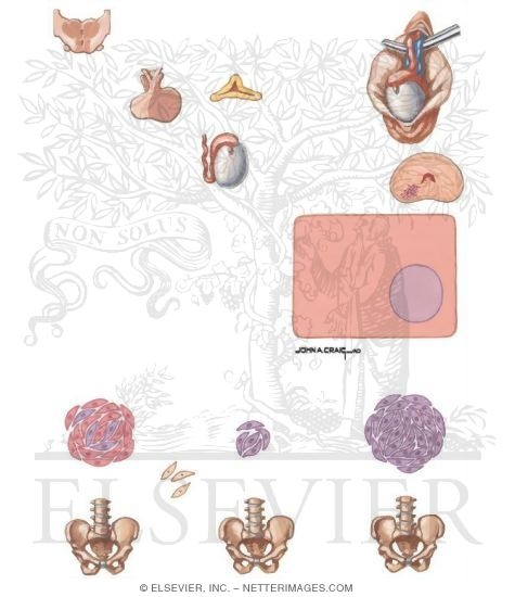 Androgen Deprivation in Metastatic Disease