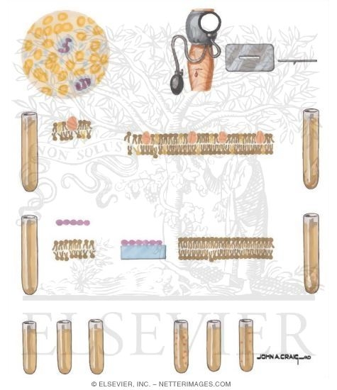 Hemostasis Tests