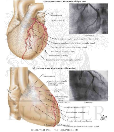 Coronary Arteri...