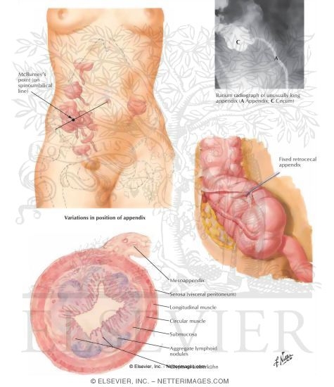 (Vermiform) Appendix