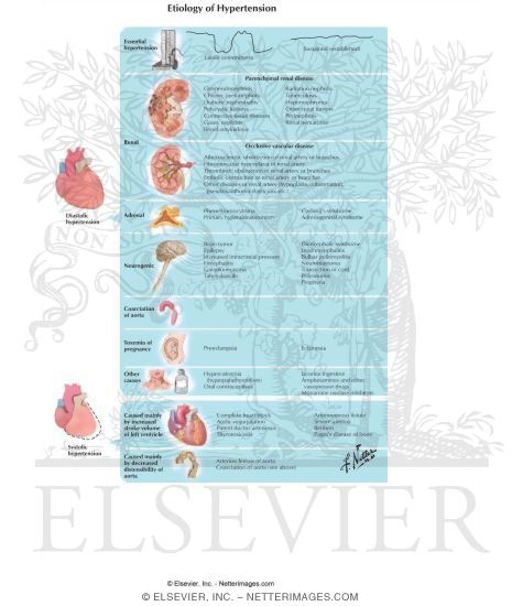 Etiology of Hypertension