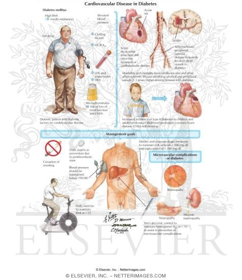 diabetes and cardiovascular disease in new Cardiovascular disease (defined as nonfatal myocardial infarction, stroke, death from cardiovascular disease, confirmed angina, or the need for coronary-artery revascularization) was assessed with standardized measures and classified by an independent committee. diabetes and cardiovascular disease in new Cardiovascular disease (defined as nonfatal myocardial infarction, stroke, death from cardiovascular disease, confirmed angina, or the need for coronary-artery revascularization) was assessed with standardized measures and classified by an independent committee.
