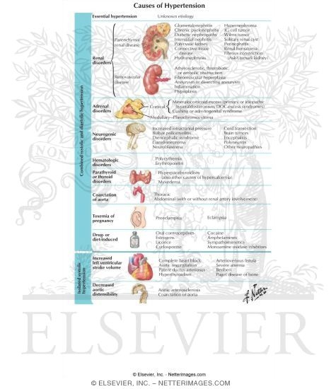 Causes of Hypertension