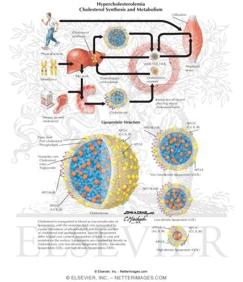 Hypercholestoerolemia: Causes