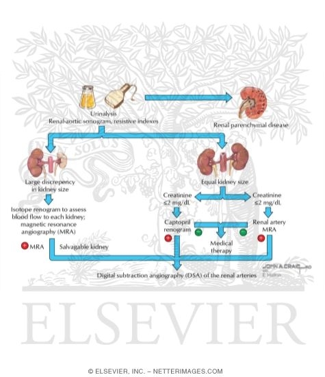 Evaluation for Renal Artery Stenosis In Subjects With Compatible Clinical Picture and Predicted Benefit of Revascularization