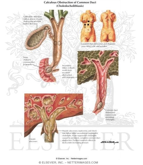 common bile duct anatomy. Obstruction of Common Duct