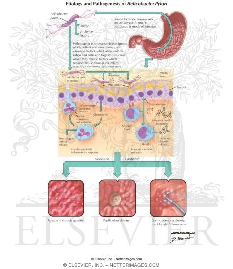Etiology and Pathogenesis of Helicobacter pylori Infection