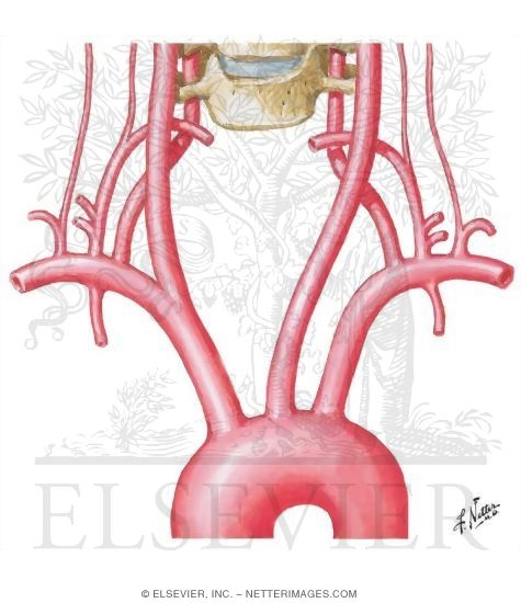 Normal and Anomalous Origins of Common Carotid and Vertebral Arteries