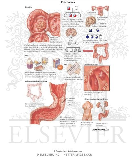 Risk Factors