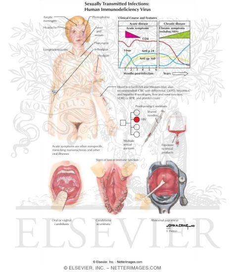 Sexually Transmitted Infections: Human Immunodeficiency Virus (HIV)