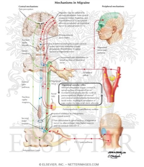 Mechanisms in Migraine