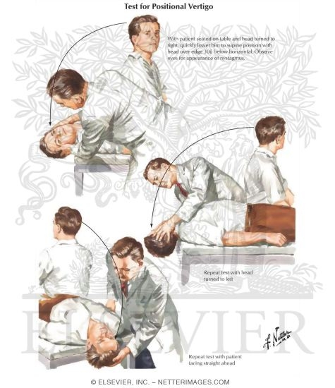 Tests for Positional Vertigo