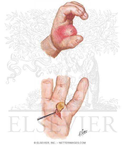 Cholesterol+synthesis+location