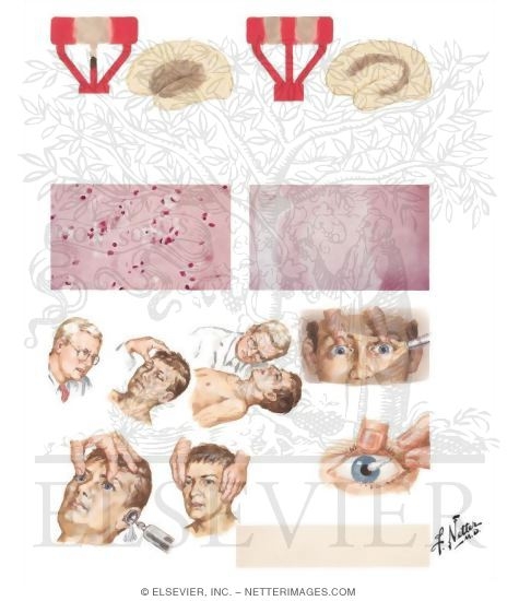 Brain Death