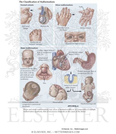 Malformations During Development