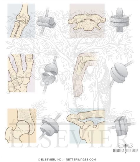 Skeletal System: Types of Synovial Joints