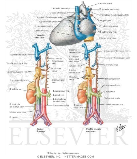 Anomalies of the Great Systemic Veins