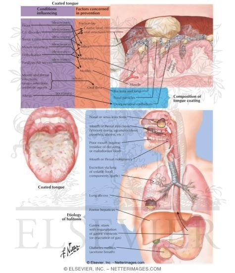 Coated Tongue and Halitosis