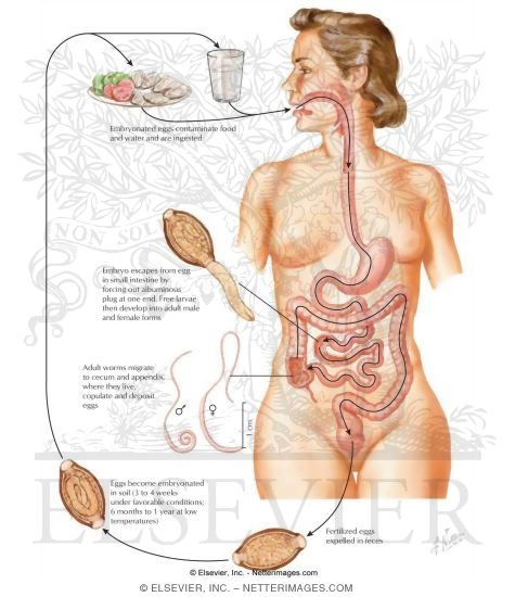 Trichuriasis: Life Cycle of Trichuris Nematode Helmith (Whipworm)