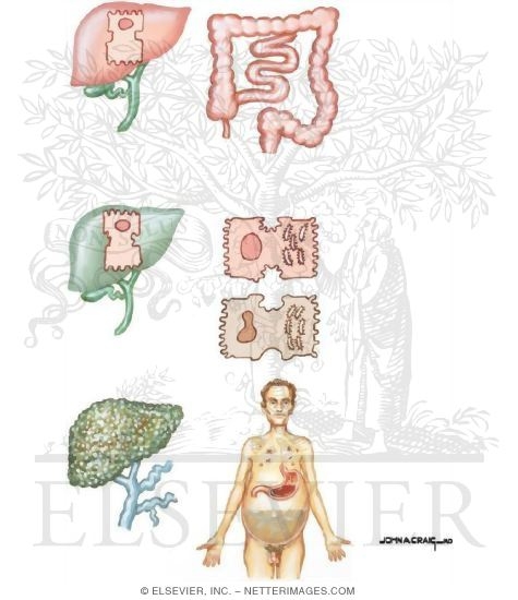Natural History of Cholestasis