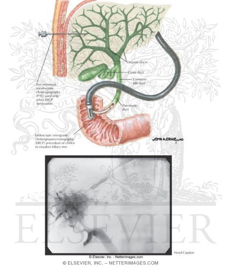 Imaging Studies of the Liver: Cholangiography