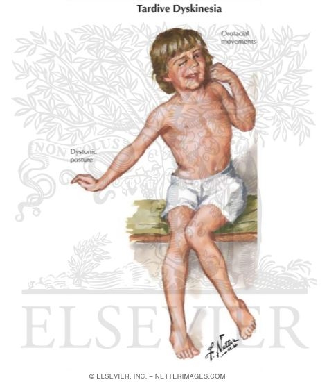 neurontin and tardive dyskinesia