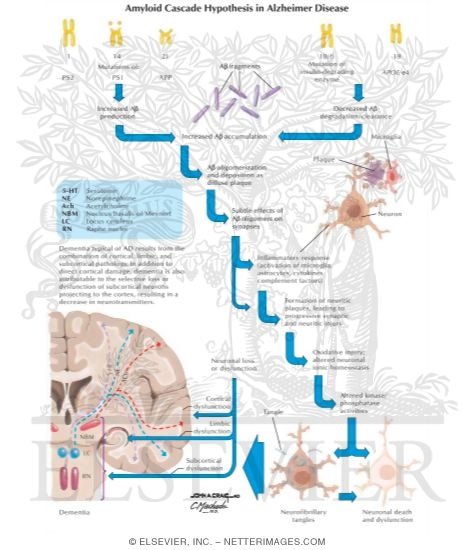 Amyloid Cascade Hypothesis In Alzheimer's Disease