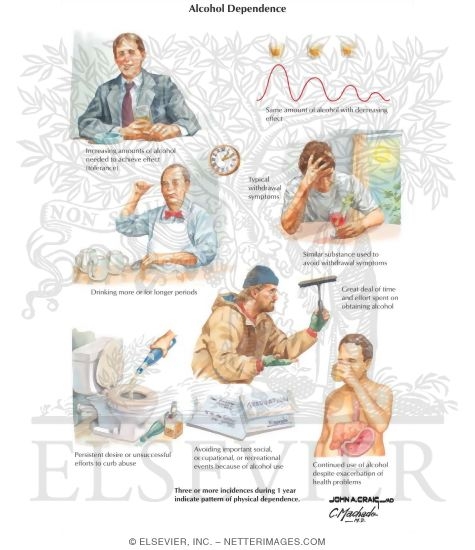 Alcohol Dependence