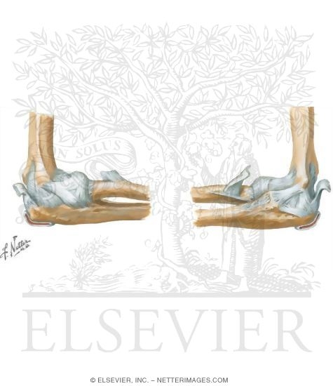 Ligaments of Right Elbow Joint