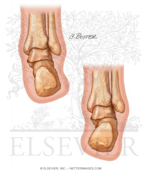 Inversion Of Foot. Inversion and Eversion