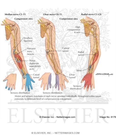 Common Sites of Upper Extremity Nerve Entrapment