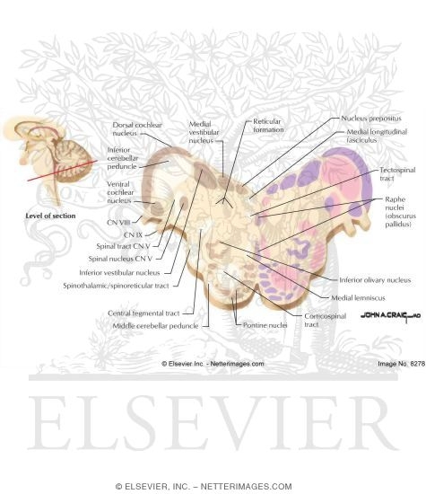 Level of Cochlear Nucleus