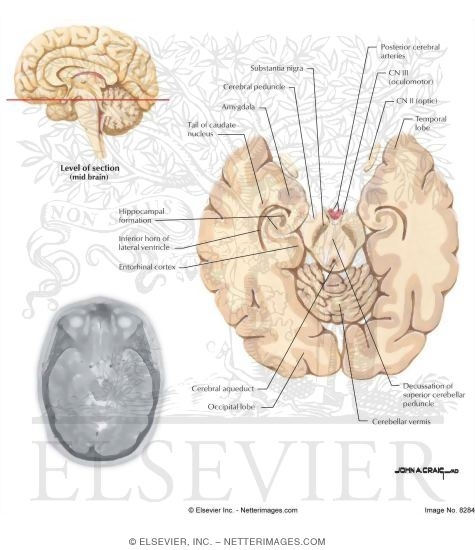 Lower Midbrain