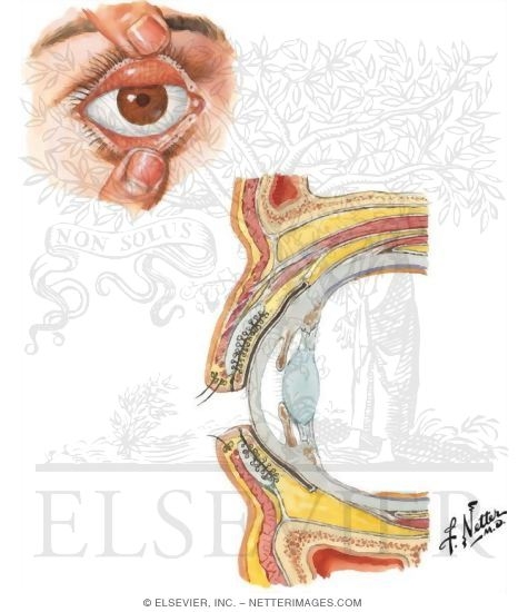 Eyelids: Anterior View and Orbital Structures