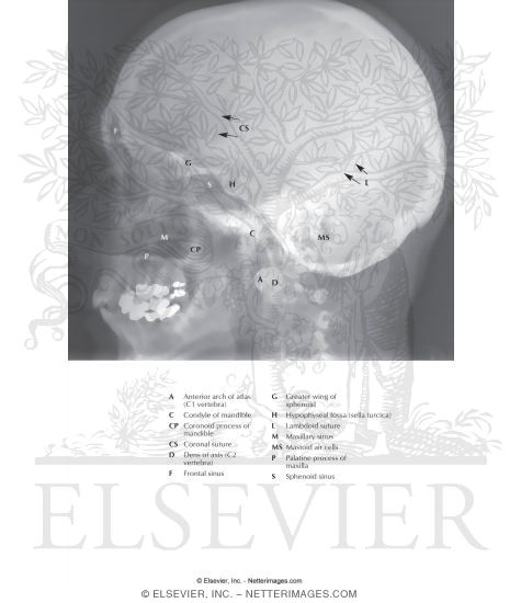 Skull: Lateral Radiograph