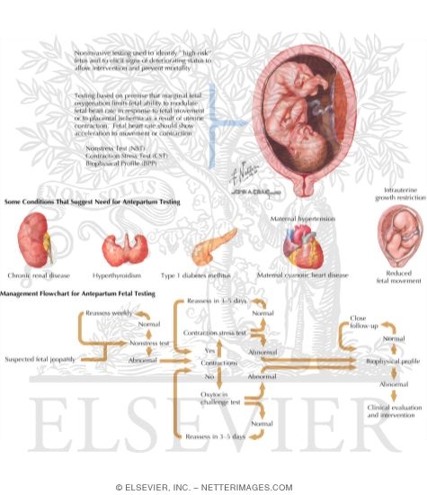 Antepartum Fetal Testing