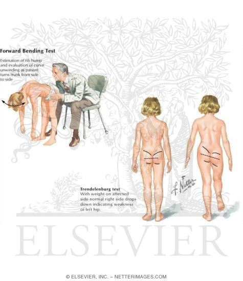Physical Examination of the Spine