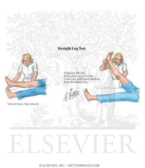 Straight Leg Test