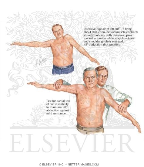 Physical Examination of the Shoulder